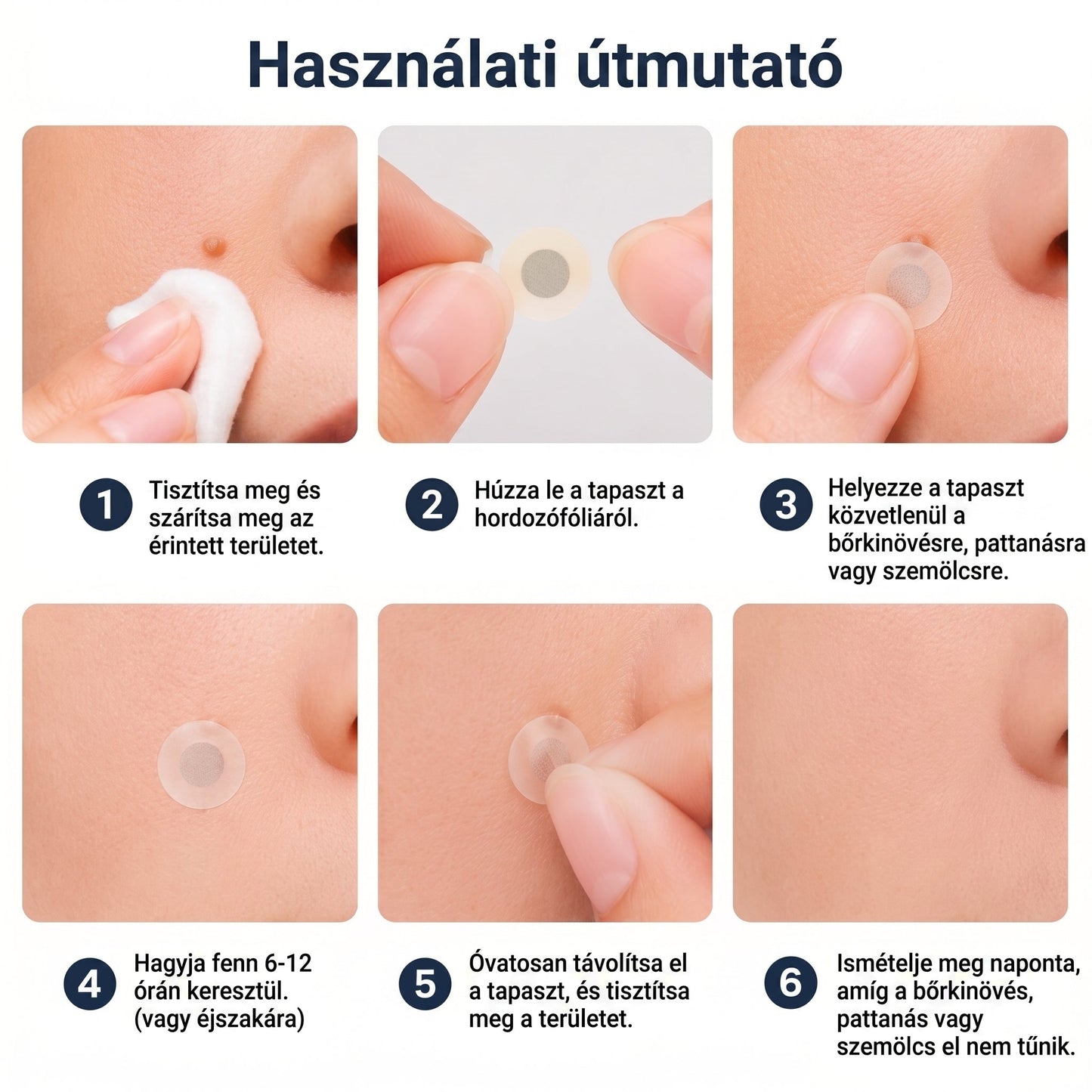 ✨ PuraCure® 2 az 1-ben mikrotűs és hidrokolloid tapasz🍀 | Kiálló anyajegyek, aknék, lapos szemölcsök és bőrnövedékek eltávolítására | Segít csökkenteni a ráncokat, hegeket és bőrhibákat | Láthatatlan tapasz az arcra és testre