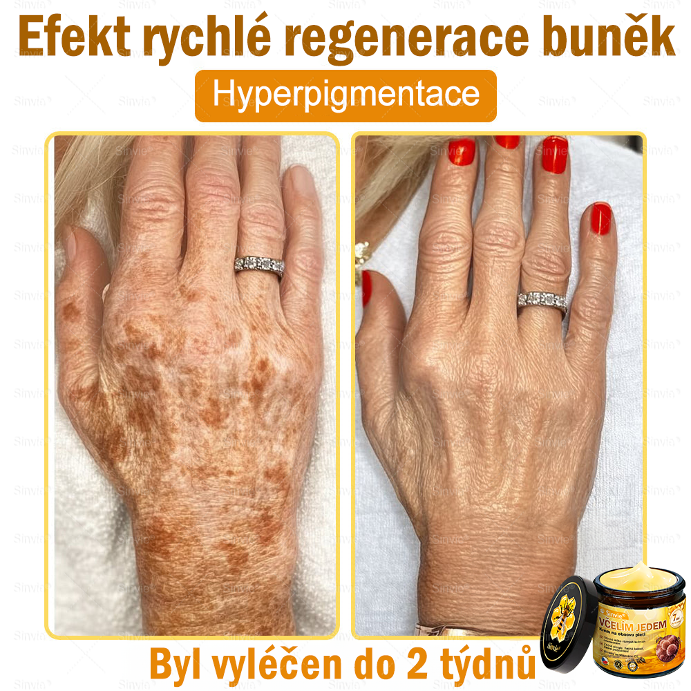 🩷Sinvie® Krém na obnovu pleti s včelím jedem 🔥  Přirozená regenerace pokožky, vyhlazení vrásek a zdravě zářivá pleť – 50 ml |