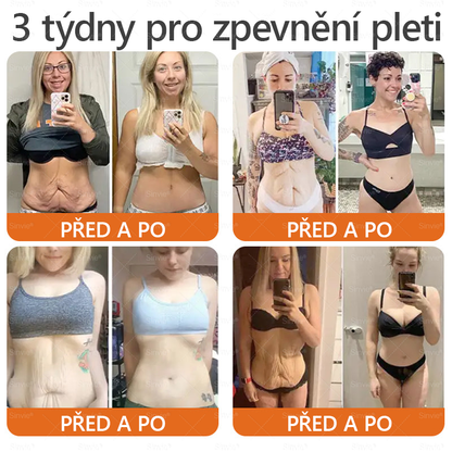 🩷Sinvie® Krém na obnovu pleti s včelím jedem 🔥  Přirozená regenerace pokožky, vyhlazení vrásek a zdravě zářivá pleť – 50 ml |