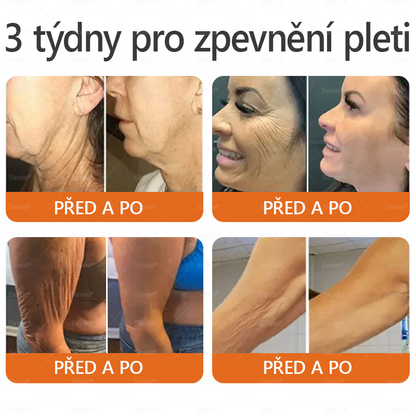🩷Sinvie® Krém na obnovu pleti s včelím jedem 🔥  Přirozená regenerace pokožky, vyhlazení vrásek a zdravě zářivá pleť – 50 ml |