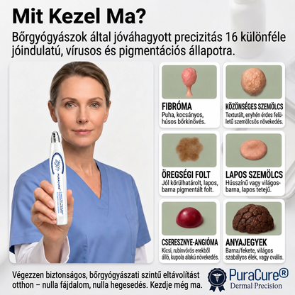 🍀PuraCure® 👩‍⚕️ 𝟕 𝐍𝐚𝐩𝐨𝐬 Bőrkinövés- és Folteltávolító Toll Fájdalommentes és Hegmentes Professzionális Rollerball