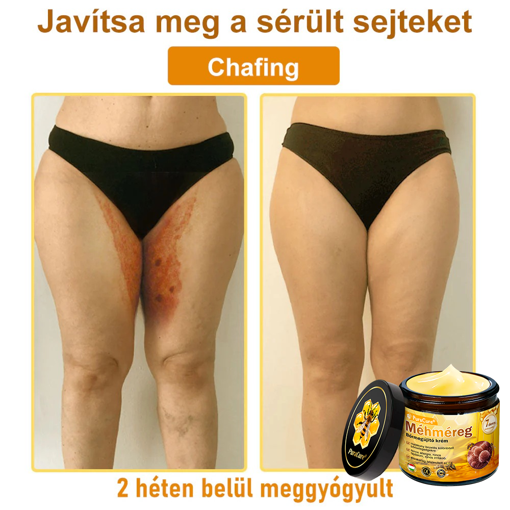 ⭐⭐⭐⭐𝐏𝐮𝐫𝐚𝐂𝐮𝐫𝐞® 𝐌é𝐡𝐦é𝐫𝐞𝐠 𝐁ő𝐫 𝐇𝐞𝐥𝐲𝐫𝐞á𝐥𝐥í𝐭ó 𝐊𝐫é𝐦 (👨‍⚕‍𝐂𝐄 𝐓𝐚𝐧ú𝐬í𝐭𝐯á𝐧𝐲)👍✅Magyar fejlesztés, magyarországi gyártás és szállítás
