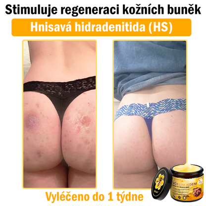 🩷Sinvie® Krém na obnovu pleti s včelím jedem 🔥  Přirozená regenerace pokožky, vyhlazení vrásek a zdravě zářivá pleť – 50 ml |