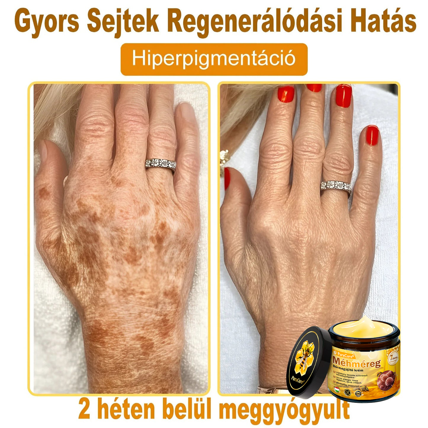 ⭐⭐⭐⭐𝐏𝐮𝐫𝐚𝐂𝐮𝐫𝐞® 𝐌é𝐡𝐦é𝐫𝐞𝐠 𝐁ő𝐫 𝐇𝐞𝐥𝐲𝐫𝐞á𝐥𝐥í𝐭ó 𝐊𝐫é𝐦 (👨‍⚕‍𝐂𝐄 𝐓𝐚𝐧ú𝐬í𝐭𝐯á𝐧𝐲)👍✅Magyar fejlesztés, magyarországi gyártás és szállítás