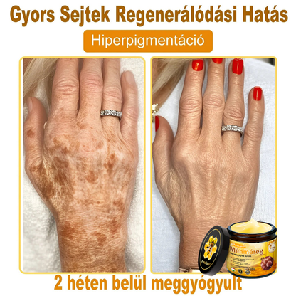 ⭐⭐⭐⭐𝐏𝐮𝐫𝐚𝐂𝐮𝐫𝐞® 𝐌é𝐡𝐦é𝐫𝐞𝐠 𝐁ő𝐫 𝐇𝐞𝐥𝐲𝐫𝐞á𝐥𝐥í𝐭ó 𝐊𝐫é𝐦 (👨‍⚕‍𝐂𝐄 𝐓𝐚𝐧ú𝐬í𝐭𝐯á𝐧𝐲)👍✅Magyar fejlesztés, magyarországi gyártás és szállítás