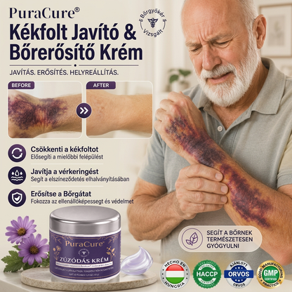 🎁👉👉Már csak 5 doboz maradt!🔥Most extra 50% kedvezmény!Ne maradj le róla!
