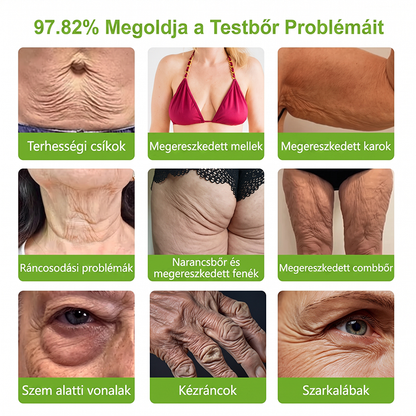 🎁☘️Már csak 5 doboz maradt!🔥Most extra 50% kedvezmény!Ne maradj le róla!