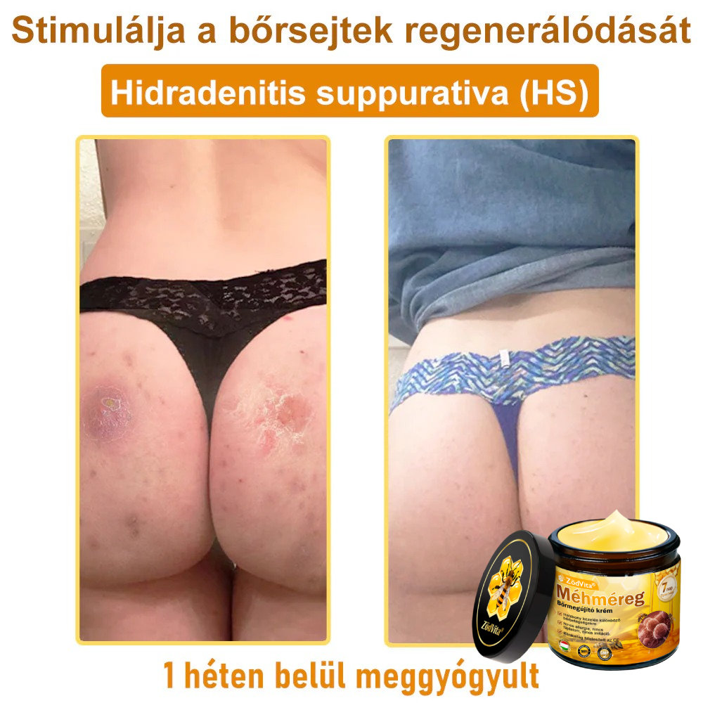 ⭐ ZödVita® Méhméreg Bőr Helyreállító Krém 🔥 Magyar fejlesztés, magyarországi gyártás és szállítás