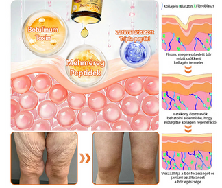 ⭐⭐⭐⭐𝐏𝐮𝐫𝐚𝐂𝐮𝐫𝐞® 𝐌é𝐡𝐦é𝐫𝐞𝐠 𝐁ő𝐫 𝐇𝐞𝐥𝐲𝐫𝐞á𝐥𝐥í𝐭ó 𝐊𝐫é𝐦 (👨‍⚕‍𝐂𝐄 𝐓𝐚𝐧ú𝐬í𝐭𝐯á𝐧𝐲)👍✅Magyar fejlesztés, magyarországi gyártás és szállítás