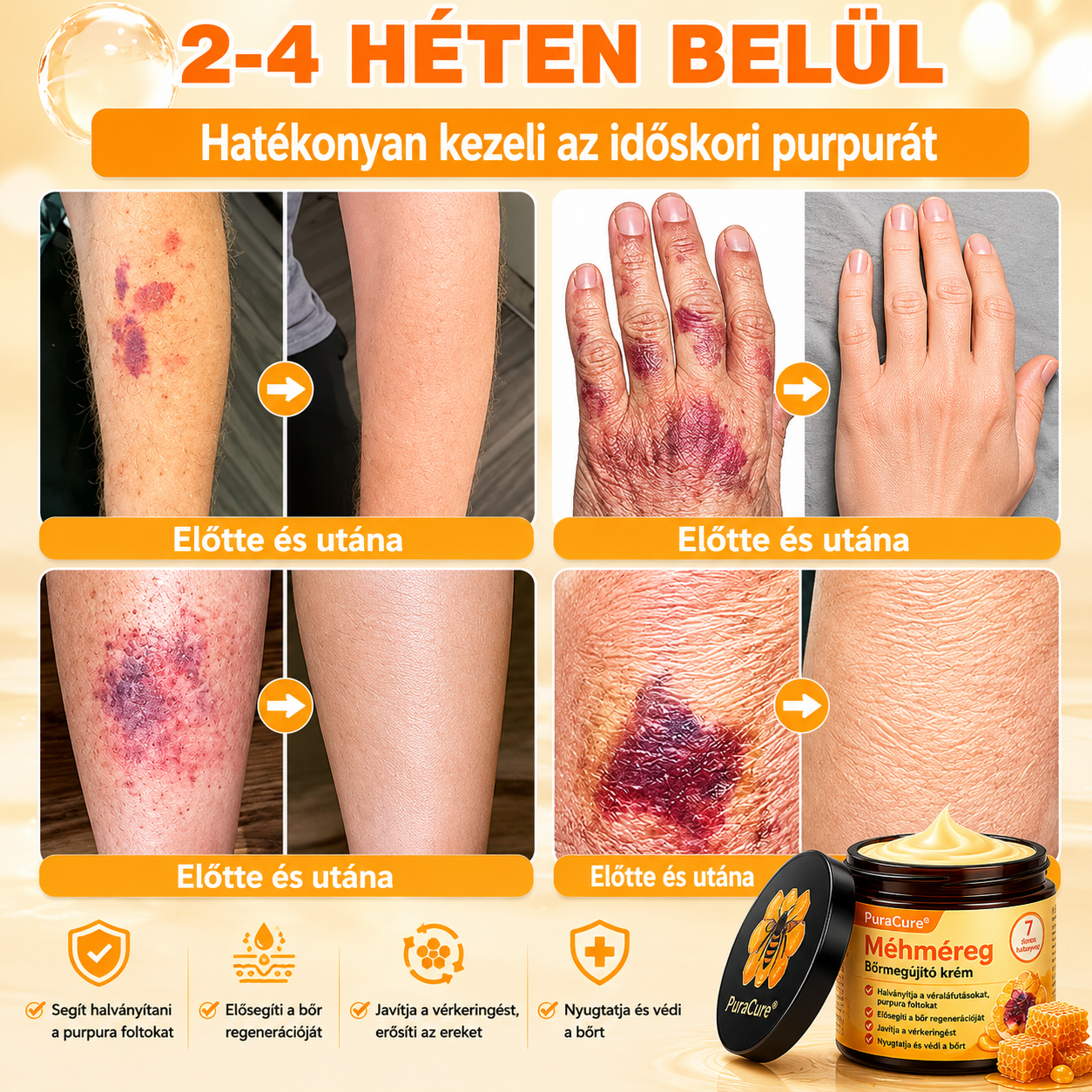 ⭐⭐⭐⭐𝐏𝐮𝐫𝐚𝐂𝐮𝐫𝐞® 𝐌é𝐡𝐦é𝐫𝐞𝐠 𝐁ő𝐫 𝐇𝐞𝐥𝐲𝐫𝐞á𝐥𝐥í𝐭ó 𝐊𝐫é𝐦 (👨‍⚕‍𝐂𝐄 𝐓𝐚𝐧ú𝐬í𝐭𝐯á𝐧𝐲)👍✅Magyar fejlesztés, magyarországi gyártás és szállítás
