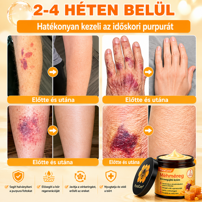 ⭐⭐⭐⭐𝐏𝐮𝐫𝐚𝐂𝐮𝐫𝐞® 𝐌é𝐡𝐦é𝐫𝐞𝐠 𝐁ő𝐫 𝐇𝐞𝐥𝐲𝐫𝐞á𝐥𝐥í𝐭ó 𝐊𝐫é𝐦 (👨‍⚕‍𝐂𝐄 𝐓𝐚𝐧ú𝐬í𝐭𝐯á𝐧𝐲)👍✅Magyar fejlesztés, magyarországi gyártás és szállítás