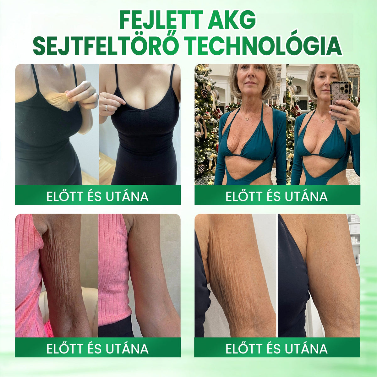 💟Medistart® AKG BŐRFESZESÍTŐ & ÖREGEDÉS ELLENI ÁPOLÁS