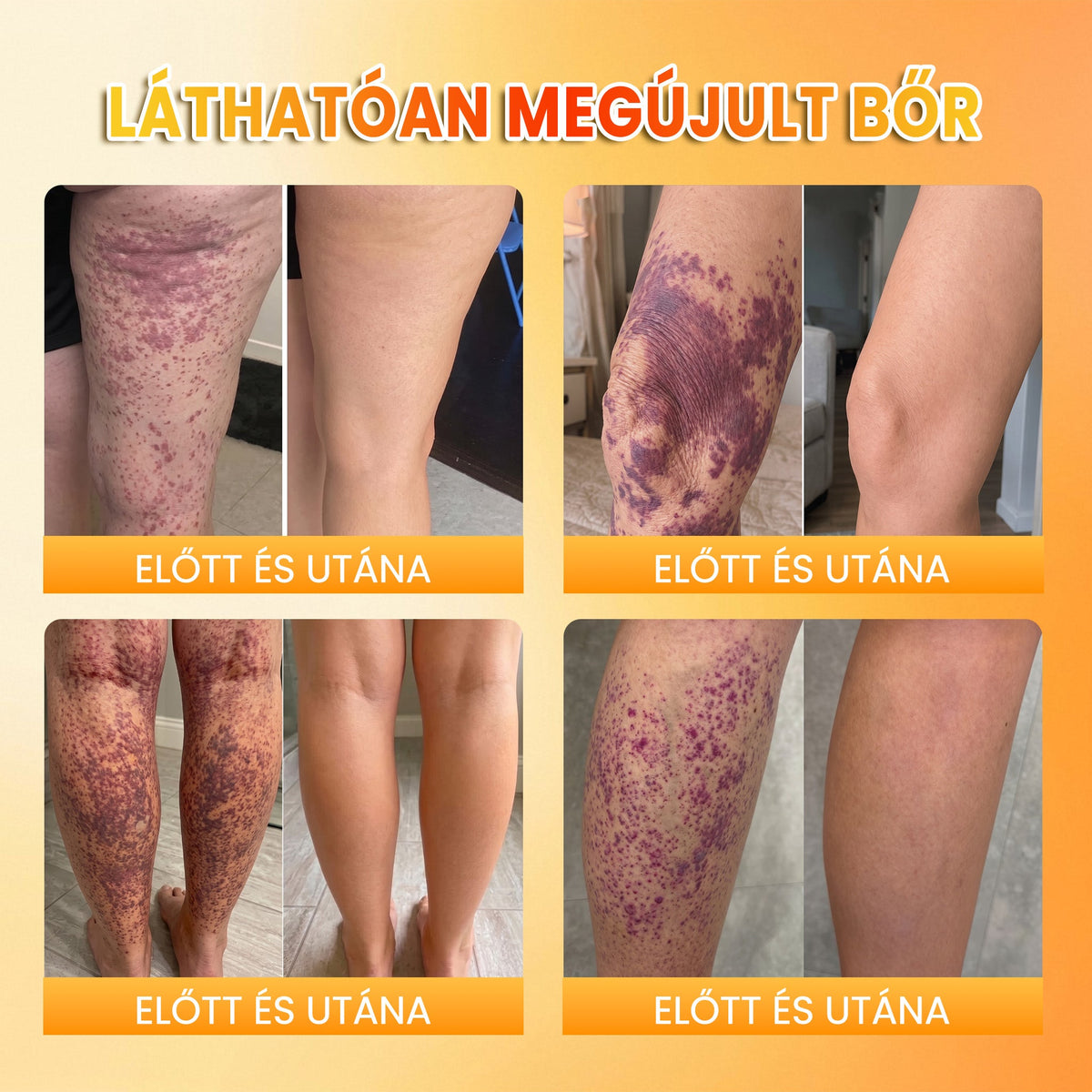 🍂🍂PuraCure® MÉHMÉREG Bőrmegújító krém