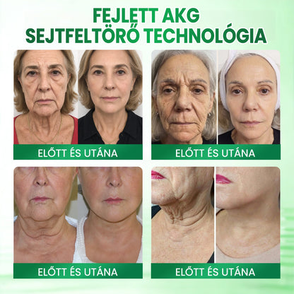 💟Medistart® AKG BŐRFESZESÍTŐ & ÖREGEDÉS ELLENI ÁPOLÁS