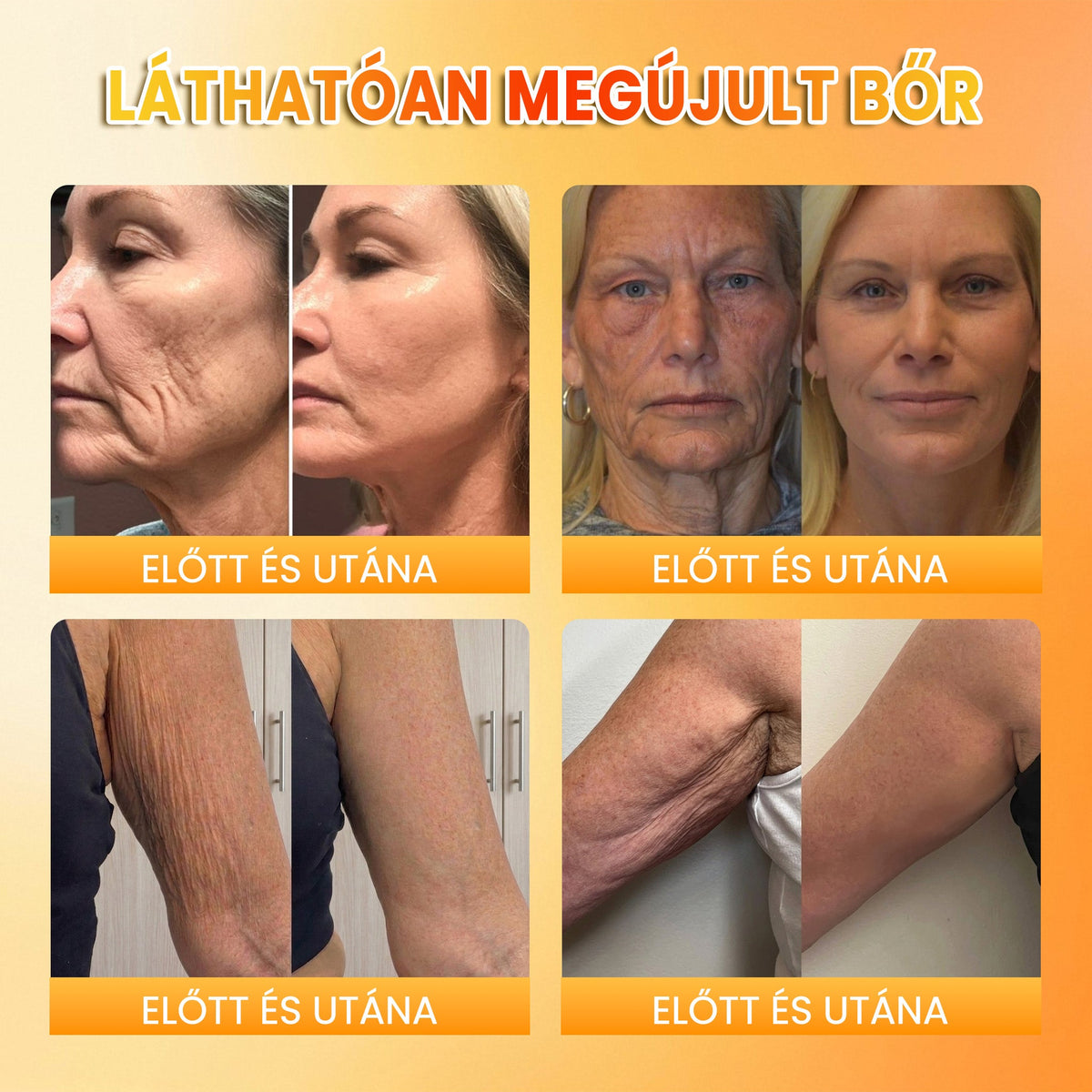 🍂🍂PuraCure® MÉHMÉREG Bőrmegújító krém