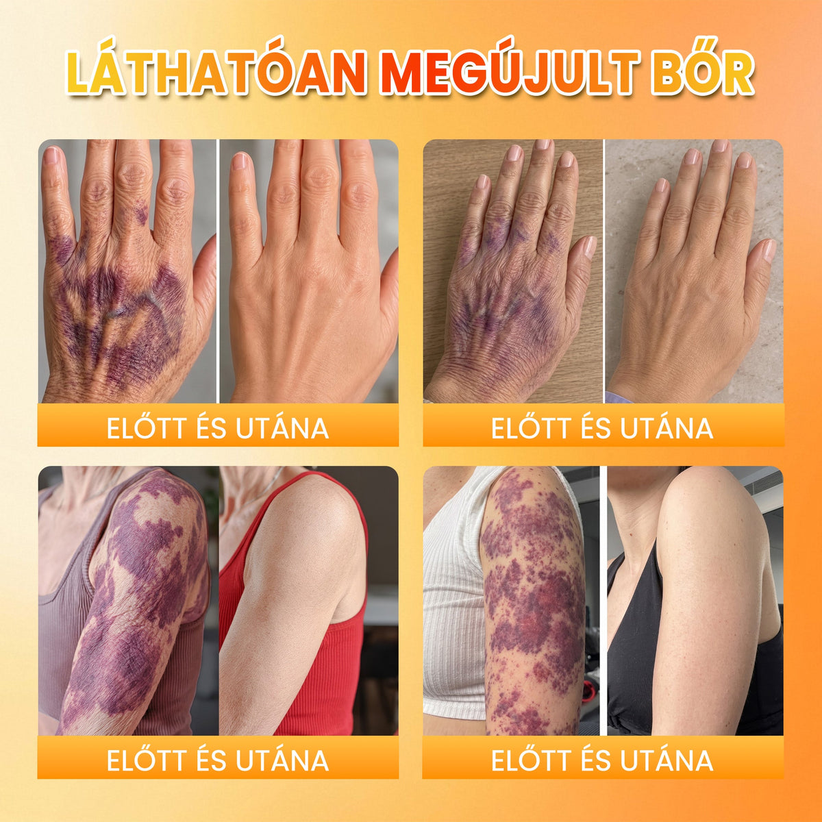 🍂🍂PuraCure® MÉHMÉREG Bőrmegújító krém