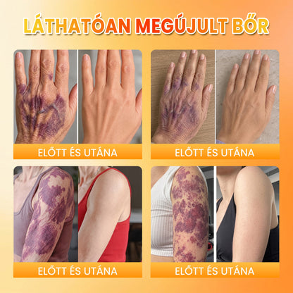 🍂🍂PuraCure® MÉHMÉREG Bőrmegújító krém
