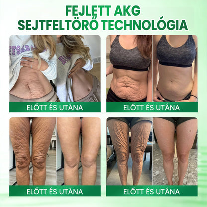 💟Medistart® AKG BŐRFESZESÍTŐ & ÖREGEDÉS ELLENI ÁPOLÁS