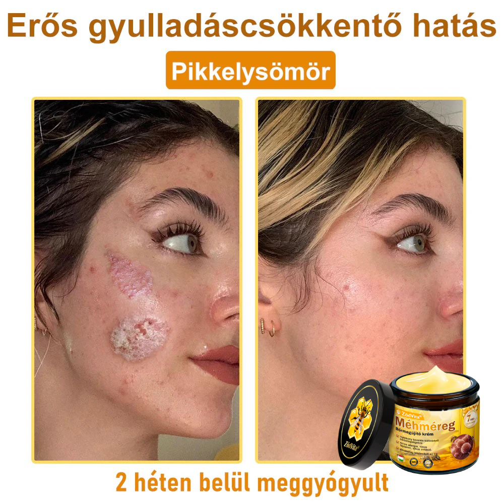 ⭐ ZödVita® Méhméreg Bőr Helyreállító Krém 🔥 Magyar fejlesztés, magyarországi gyártás és szállítás