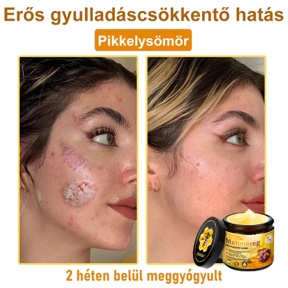 ⭐ ZödVita® Méhméreg Bőr Helyreállító Krém 🔥 Magyar fejlesztés, magyarországi gyártás és szállítás