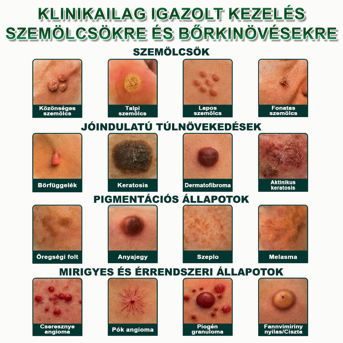 🔥𝐏𝐮𝐫𝐚𝐂𝐮𝐫𝐞® 𝐌𝐈𝐊𝐑𝐎𝐓Ű𝐒 𝐁Ő𝐑𝐊𝐈𝐍Ö𝐕É𝐒-𝐄𝐋𝐓Á𝐕𝐎𝐋Í𝐓Ó 𝐓𝐀𝐏𝐀𝐒𝐙𝐎𝐊 —𝟕 𝐍𝐀𝐏𝐎𝐒 𝐂É𝐋𝐙𝐎𝐓𝐓 𝐄𝐋𝐓Á𝐕𝐎𝐋Í𝐓Á𝐒 𝐁Ő𝐑𝐍𝐘Ú𝐋𝐕Á𝐍𝐘𝐎𝐊, 𝐒𝐙𝐄𝐌Ö𝐋𝐂𝐒Ö𝐊 É𝐒 𝐊𝐈𝐄𝐌𝐄𝐋𝐊𝐄𝐃Ő 𝐁Ő𝐑𝐇𝐈𝐁Á𝐊 𝐄𝐋𝐋𝐄𝐍