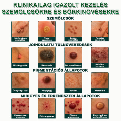 🔥𝐏𝐮𝐫𝐚𝐂𝐮𝐫𝐞® 𝐌𝐈𝐊𝐑𝐎𝐓Ű𝐒 𝐁Ő𝐑𝐊𝐈𝐍Ö𝐕É𝐒-𝐄𝐋𝐓Á𝐕𝐎𝐋Í𝐓Ó 𝐓𝐀𝐏𝐀𝐒𝐙𝐎𝐊 —𝟕 𝐍𝐀𝐏𝐎𝐒 𝐂É𝐋𝐙𝐎𝐓𝐓 𝐄𝐋𝐓Á𝐕𝐎𝐋Í𝐓Á𝐒 𝐁Ő𝐑𝐍𝐘Ú𝐋𝐕Á𝐍𝐘𝐎𝐊, 𝐒𝐙𝐄𝐌Ö𝐋𝐂𝐒Ö𝐊 É𝐒 𝐊𝐈𝐄𝐌𝐄𝐋𝐊𝐄𝐃Ő 𝐁Ő𝐑𝐇𝐈𝐁Á𝐊 𝐄𝐋𝐋𝐄𝐍