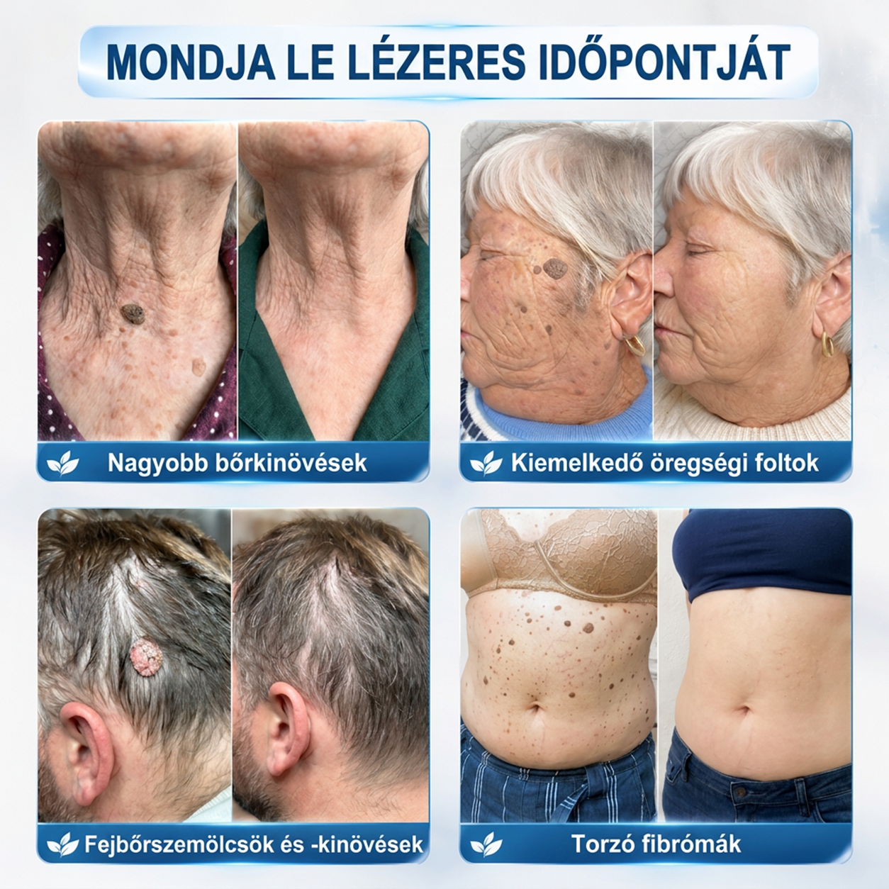🍀PuraCure® 👩‍⚕️ 𝟕 𝐍𝐚𝐩𝐨𝐬 Bőrkinövés- és Folteltávolító Toll Fájdalommentes és Hegmentes Professzionális Rollerball