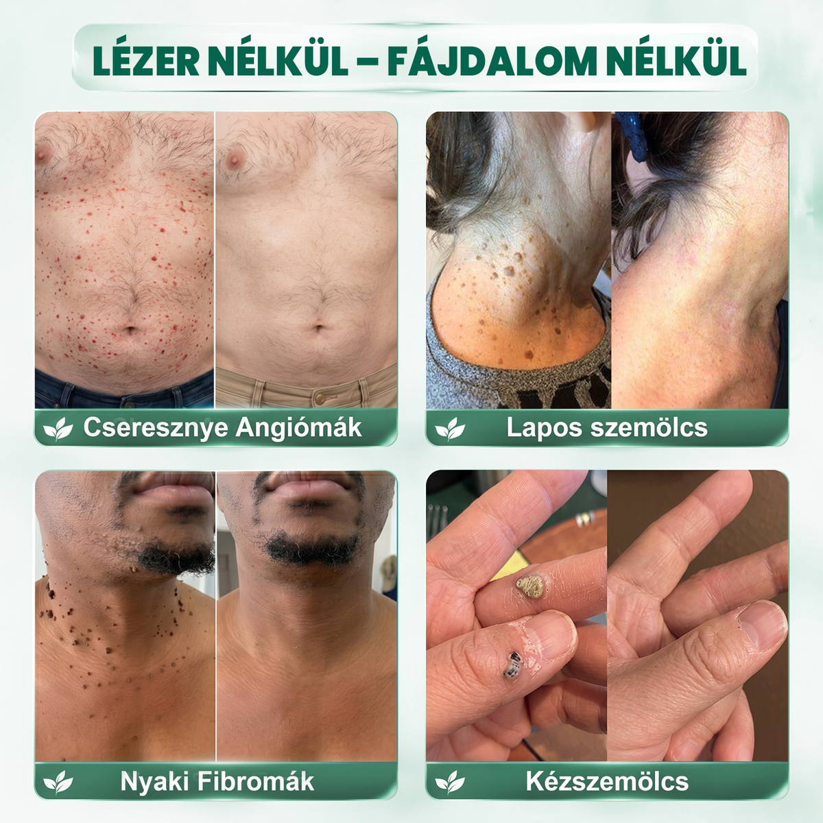 🔥𝐏𝐮𝐫𝐚𝐂𝐮𝐫𝐞® 𝐌𝐈𝐊𝐑𝐎𝐓Ű𝐒 𝐁Ő𝐑𝐊𝐈𝐍Ö𝐕É𝐒-𝐄𝐋𝐓Á𝐕𝐎𝐋Í𝐓Ó 𝐓𝐀𝐏𝐀𝐒𝐙𝐎𝐊 —𝟕 𝐍𝐀𝐏𝐎𝐒 𝐂É𝐋𝐙𝐎𝐓𝐓 𝐄𝐋𝐓Á𝐕𝐎𝐋Í𝐓Á𝐒 𝐁Ő𝐑𝐍𝐘Ú𝐋𝐕Á𝐍𝐘𝐎𝐊, 𝐒𝐙𝐄𝐌Ö𝐋𝐂𝐒Ö𝐊 É𝐒 𝐊𝐈𝐄𝐌𝐄𝐋𝐊𝐄𝐃Ő 𝐁Ő𝐑𝐇𝐈𝐁Á𝐊 𝐄𝐋𝐋𝐄𝐍