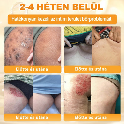 🌟𝐏𝐮𝐫𝐚𝐂𝐮𝐫𝐞® 𝐌é𝐡𝐦é𝐫𝐞𝐠 𝐁ő𝐫 𝐇𝐞𝐥𝐲𝐫𝐞á𝐥𝐥í𝐭ó 𝐊𝐫é𝐦 (👨‍⚕‍𝐂𝐄 𝐓𝐚𝐧ú𝐬í𝐭𝐯á𝐧𝐲)👍✅Magyar fejlesztés, magyarországi gyártás és szállítás