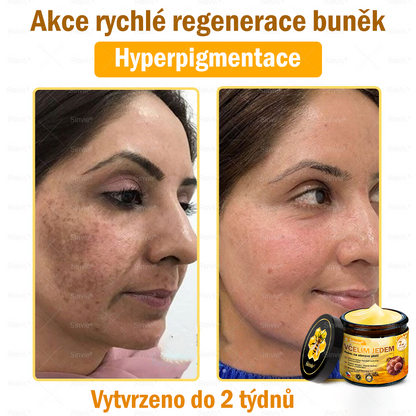 🩷Sinvie® Krém na obnovu pleti s včelím jedem 🔥  Přirozená regenerace pokožky, vyhlazení vrásek a zdravě zářivá pleť – 50 ml |