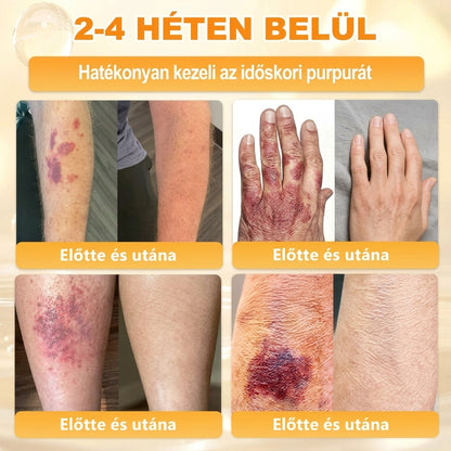 🌟𝐏𝐮𝐫𝐚𝐂𝐮𝐫𝐞® 𝐌é𝐡𝐦é𝐫𝐞𝐠 𝐁ő𝐫 𝐇𝐞𝐥𝐲𝐫𝐞á𝐥𝐥í𝐭ó 𝐊𝐫é𝐦 (👨‍⚕‍𝐂𝐄 𝐓𝐚𝐧ú𝐬í𝐭𝐯á𝐧𝐲)👍✅Magyar fejlesztés, magyarországi gyártás és szállítás