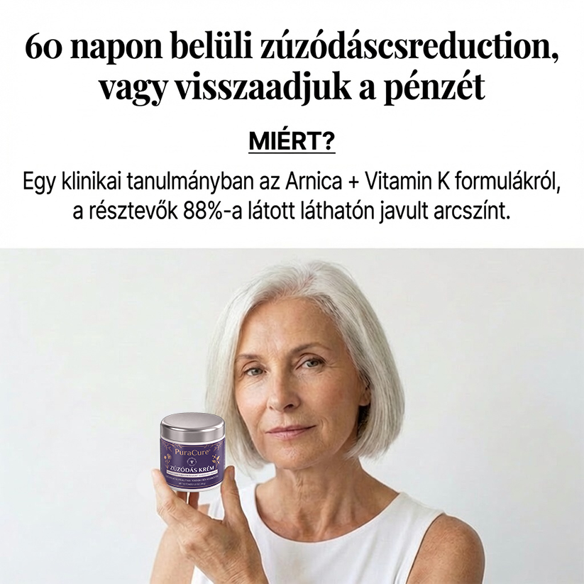 🎁👉👉Már csak 5 doboz maradt!🔥Most extra 50% kedvezmény!Ne maradj le róla!