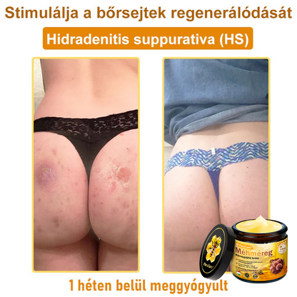 ⭐⭐⭐⭐𝐏𝐮𝐫𝐚𝐂𝐮𝐫𝐞® 𝐌é𝐡𝐦é𝐫𝐞𝐠 𝐁ő𝐫 𝐇𝐞𝐥𝐲𝐫𝐞á𝐥𝐥í𝐭ó 𝐊𝐫é𝐦 (👨‍⚕‍𝐂𝐄 𝐓𝐚𝐧ú𝐬í𝐭𝐯á𝐧𝐲)👍✅Magyar fejlesztés, magyarországi gyártás és szállítás