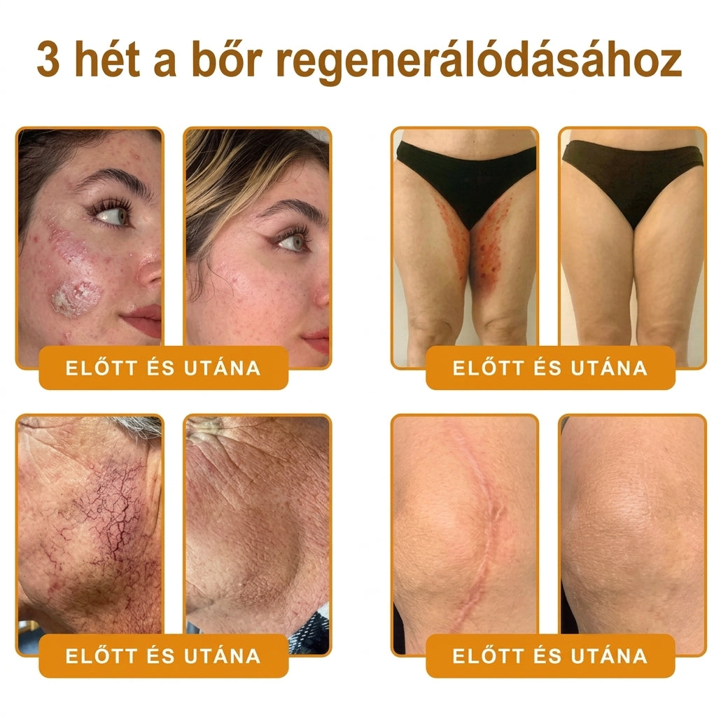 🌟𝐏𝐮𝐫𝐚𝐂𝐮𝐫𝐞® 𝐌é𝐡𝐦é𝐫𝐞𝐠 𝐁ő𝐫 𝐇𝐞𝐥𝐲𝐫𝐞á𝐥𝐥í𝐭ó 𝐊𝐫é𝐦 (👨‍⚕‍𝐂𝐄 𝐓𝐚𝐧ú𝐬í𝐭𝐯á𝐧𝐲)👍✅Magyar fejlesztés, magyarországi gyártás és szállítás