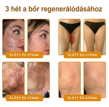 🌟𝐏𝐮𝐫𝐚𝐂𝐮𝐫𝐞® 𝐌é𝐡𝐦é𝐫𝐞𝐠 𝐁ő𝐫 𝐇𝐞𝐥𝐲𝐫𝐞á𝐥𝐥í𝐭ó 𝐊𝐫é𝐦 (👨‍⚕‍𝐂𝐄 𝐓𝐚𝐧ú𝐬í𝐭𝐯á𝐧𝐲)👍✅Magyar fejlesztés, magyarországi gyártás és szállítás