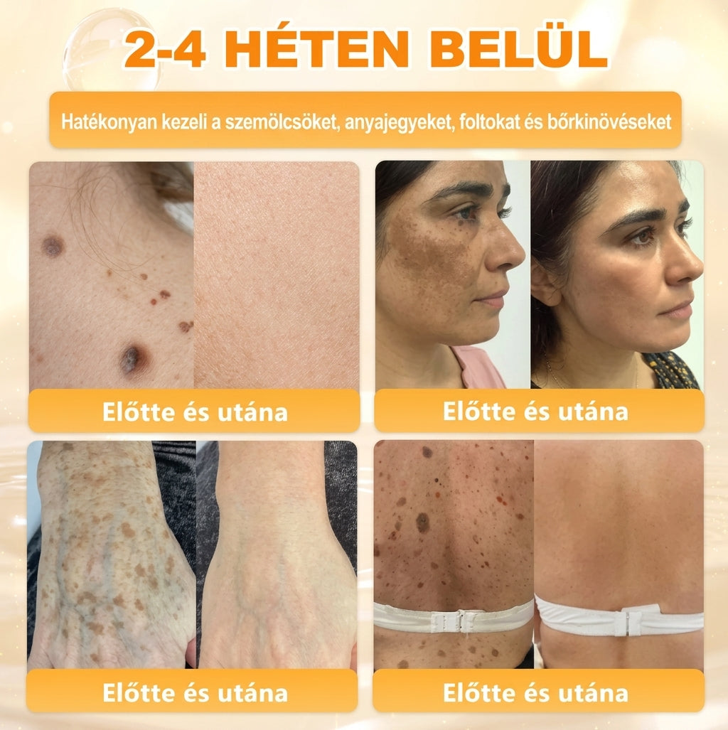 🌟𝐏𝐮𝐫𝐚𝐂𝐮𝐫𝐞® 𝐌é𝐡𝐦é𝐫𝐞𝐠 𝐁ő𝐫 𝐇𝐞𝐥𝐲𝐫𝐞á𝐥𝐥í𝐭ó 𝐊𝐫é𝐦 (👨‍⚕‍𝐂𝐄 𝐓𝐚𝐧ú𝐬í𝐭𝐯á𝐧𝐲)👍✅Magyar fejlesztés, magyarországi gyártás és szállítás