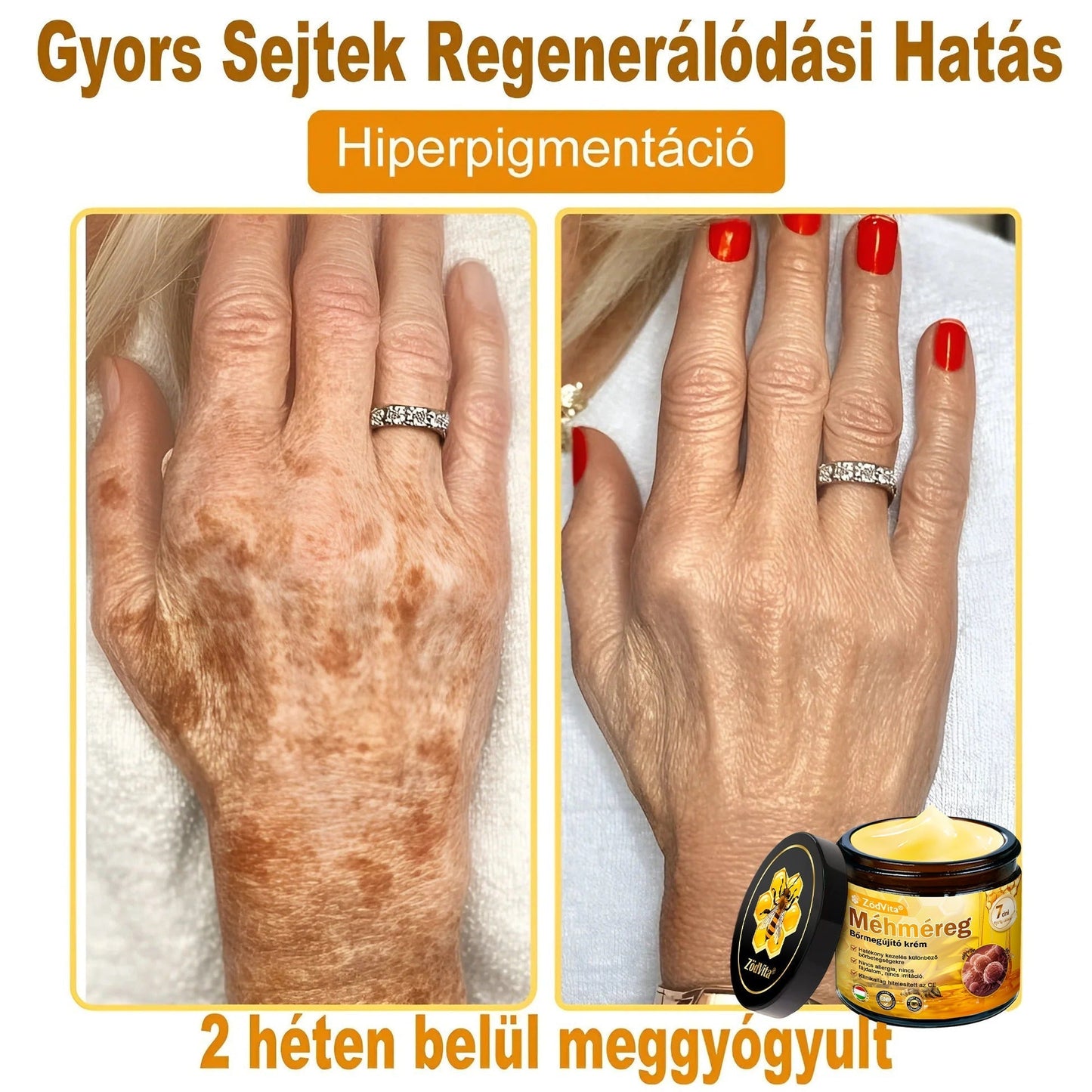 ⭐ ZödVita® Méhméreg Bőr Helyreállító Krém 🔥 Magyar fejlesztés, magyarországi gyártás és szállítás