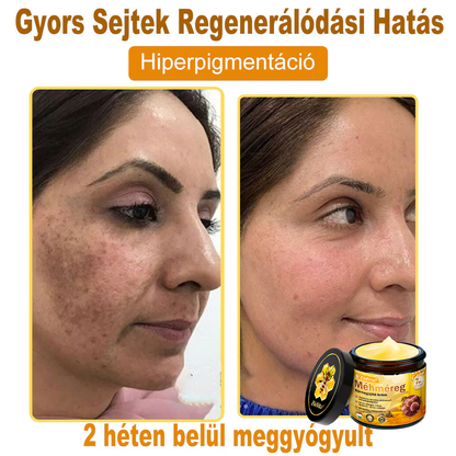 ⭐ ZödVita® Méhméreg Bőr Helyreállító Krém 🔥 Magyar fejlesztés, magyarországi gyártás és szállítás